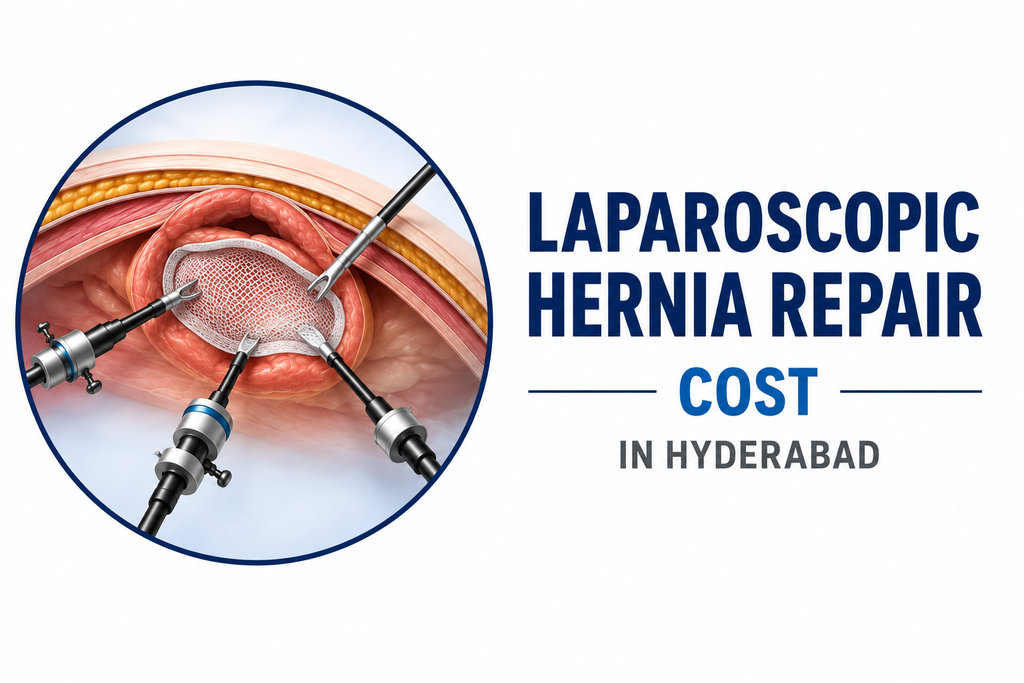 Cover image — Laparoscopic Hernia Repair Cost in Hyderabad